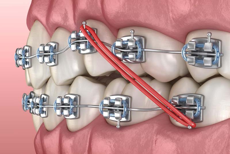 ارتودنسی دندان در صادقیه تهران
