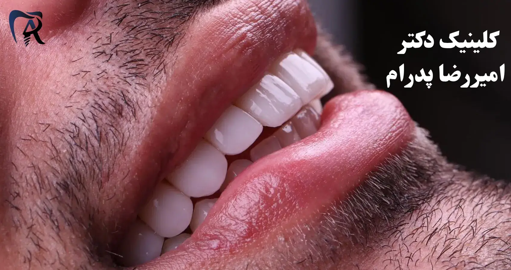 رضایت مراجعه کننده لمینت دندان در صادقیه