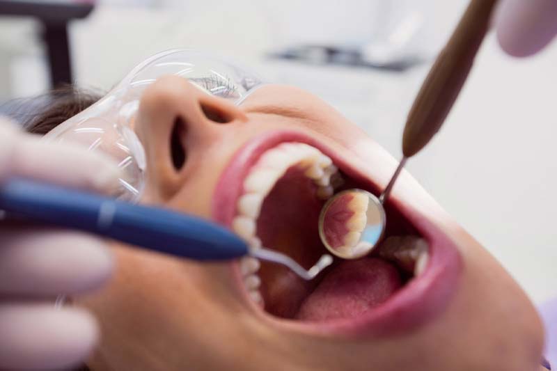 درمان ریشه دندان در صادقیه تهران چه مزایایی دارد؟