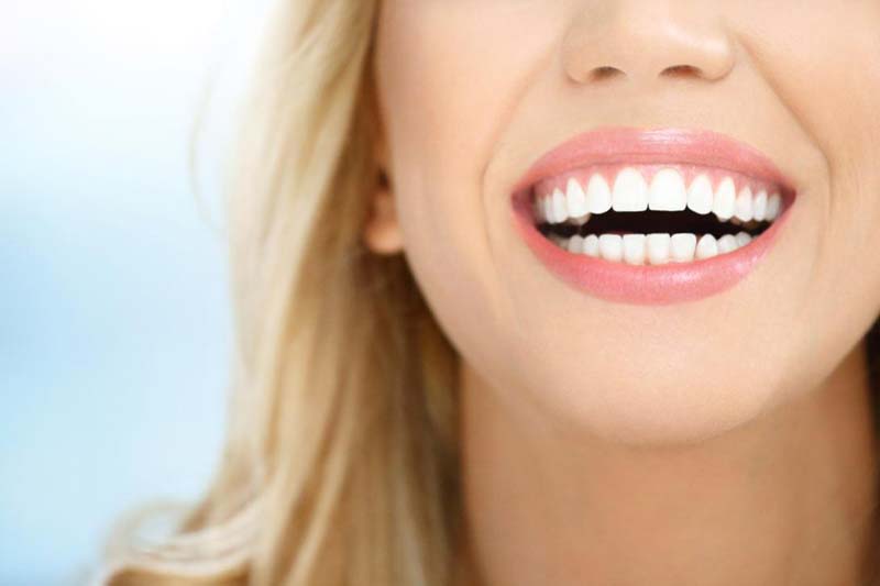 دندانپزشک زیبایی در صادقیه تهران