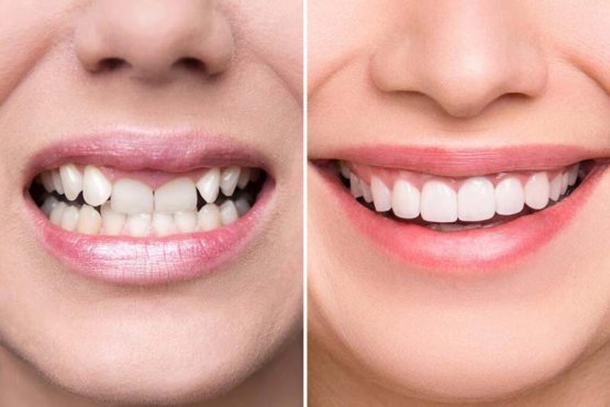 چرا صادقیه تهران را برای اصلاح طرح لبخند انتخاب کنیم؟