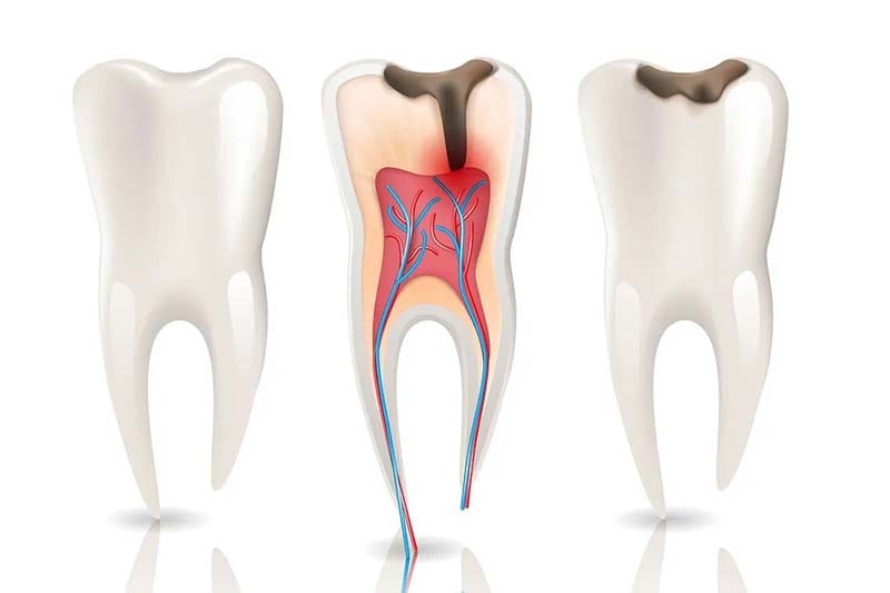 چرا صادقیه تهران را برای درمان ریشه دندان انتخاب کنیم؟