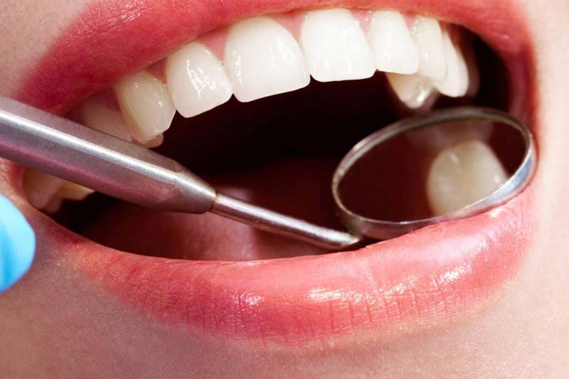 چه عواملی بر هزینه کامپوزیت دندان در غرب تهران موثر هستند؟