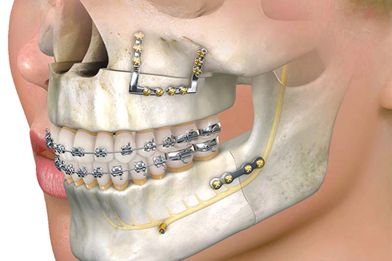 جراح فک و صورت در صادقیه تهران