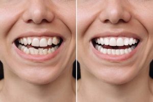 هزینه دندانپزشکی زیبایی در صادقیه تهران
