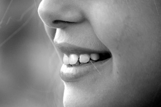 آیا لمینت دندان برای کودکان مناسب است؟