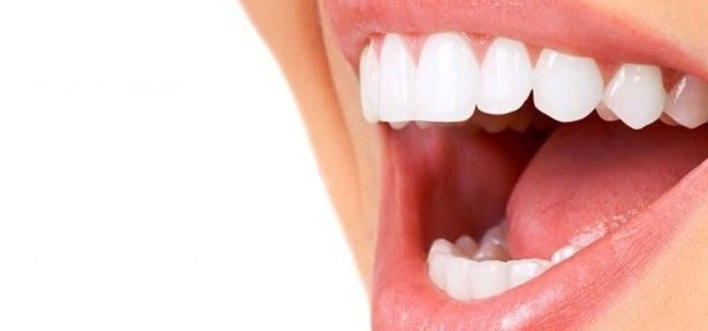 لیفت لثه با لیزر