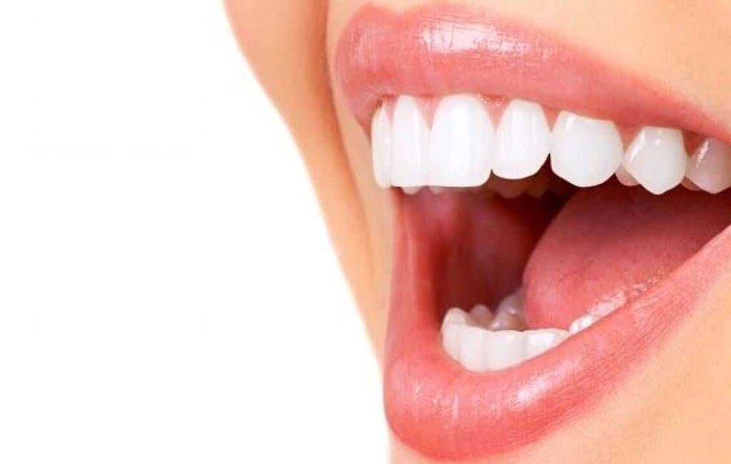 لیفت لثه با لیزر