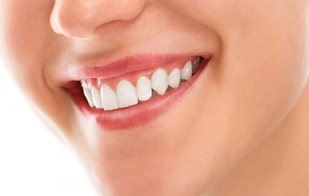 مزایای لیفت لثه با لیزر نسبت به روش های سنتی