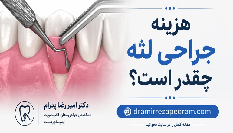 هزینه جراحی لثه چقدر است؟