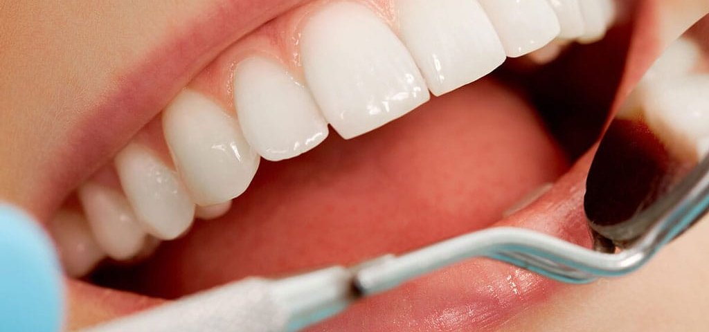 کامپوزیت IPS چیست؟