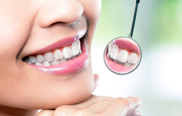 آیا کامپوزیت دندان باعث خرابی دندان می‌شود؟