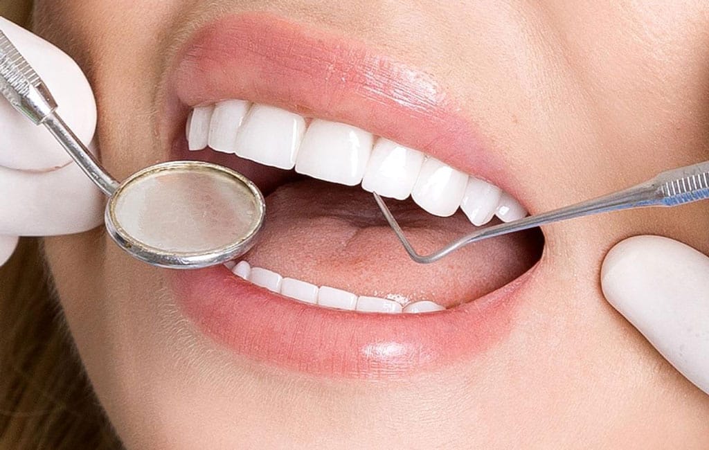 علایم خرابی کامپوزیت دندان چیست و چگونه از آن جلوگیری کنیم؟