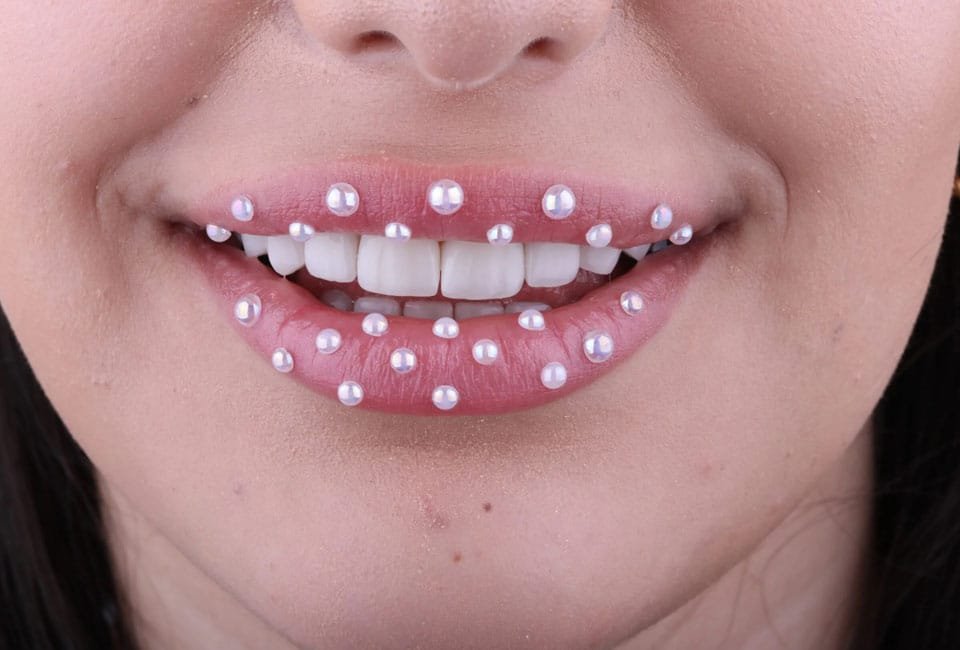 کامپوزیت دندان چیست؟