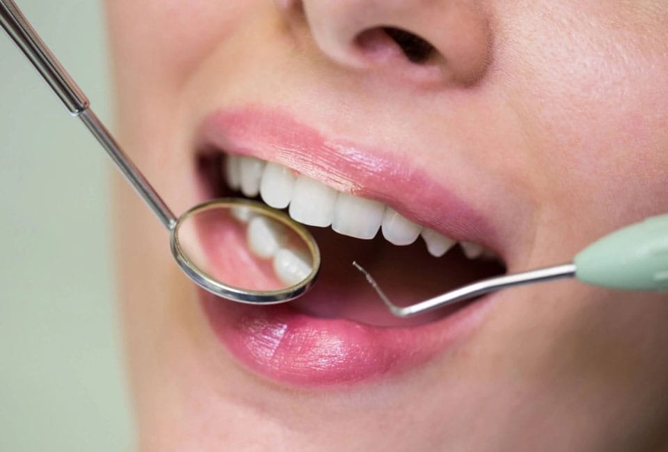 بهترین رنگ کامپوزیت دندان برای چهره شما کدام است؟