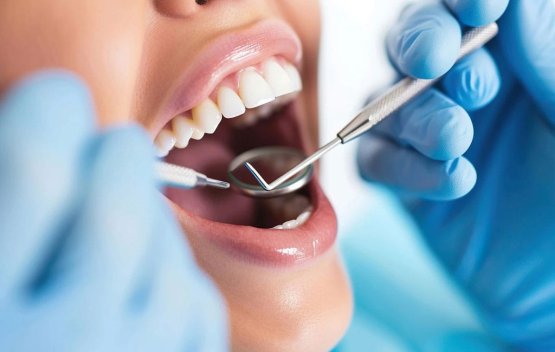 بهترین سن برای انجام کامپوزیت دندان چه زمانی است؟