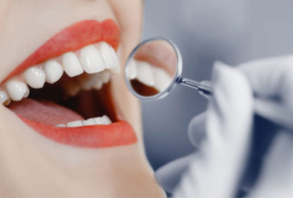 طول عمر کامپوزیت دندان چقدر است؟