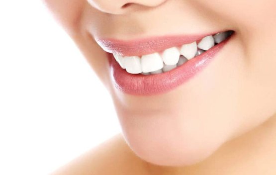 تفاوت لمینت و کامپوزیت دندان چیست؟