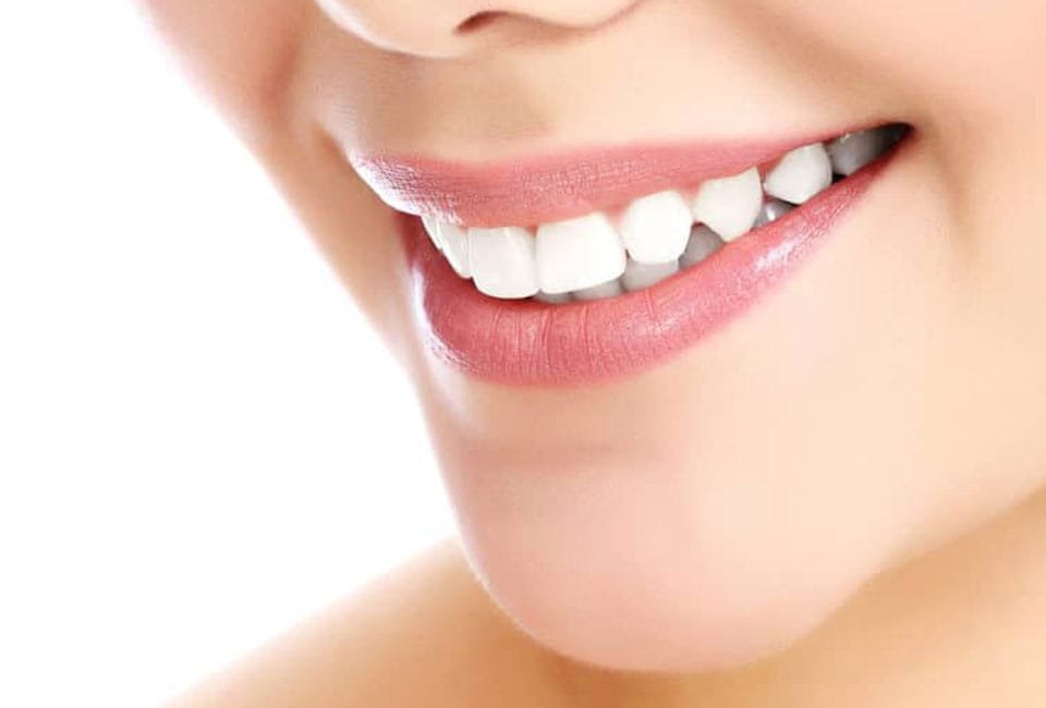 تفاوت لمینت و کامپوزیت دندان چیست؟