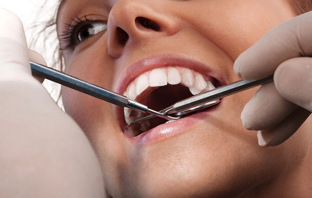 فاکتور های مهم در انتخاب رنگ کامپوزیت چیست؟ محبوب ترین رنگ ها کدام اند؟