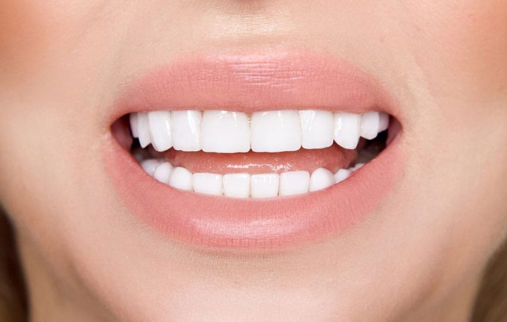 روش های افزایش طول عمر کامپوزیت دندان