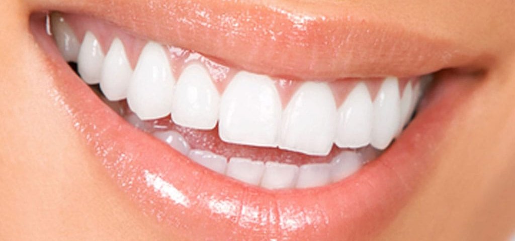 آسیب کامپوزیت به دندان طبیعی