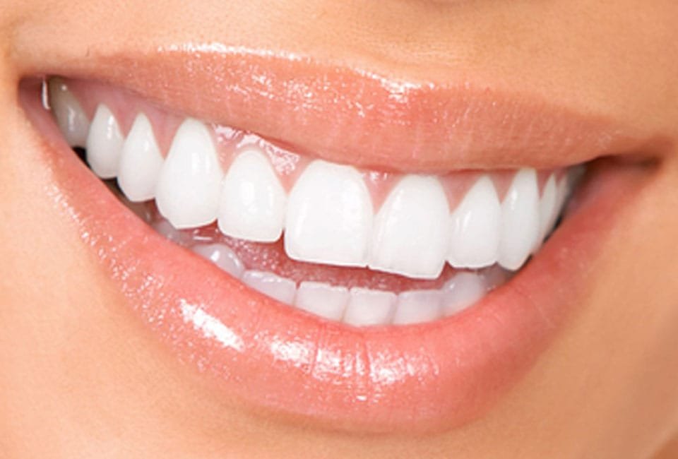 آسیب کامپوزیت به دندان طبیعی