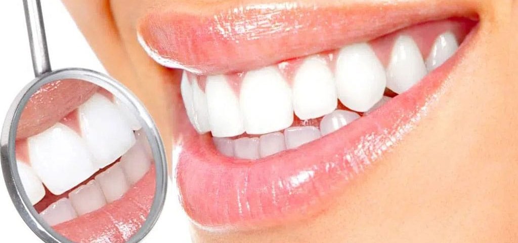 انواع کامپوزیت دندان