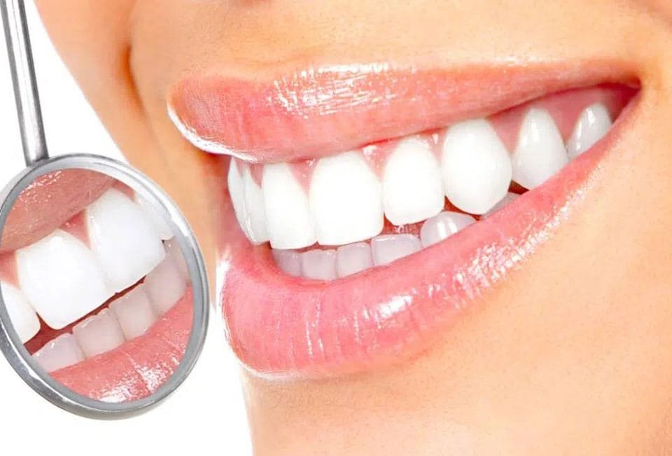 انواع کامپوزیت دندان