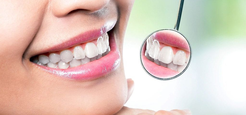 آیا کامپوزیت دندان باعث خرابی دندان می‌شود؟