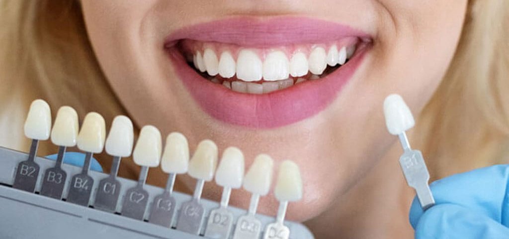 کدام کامپوزیت دندان بهتر است؟