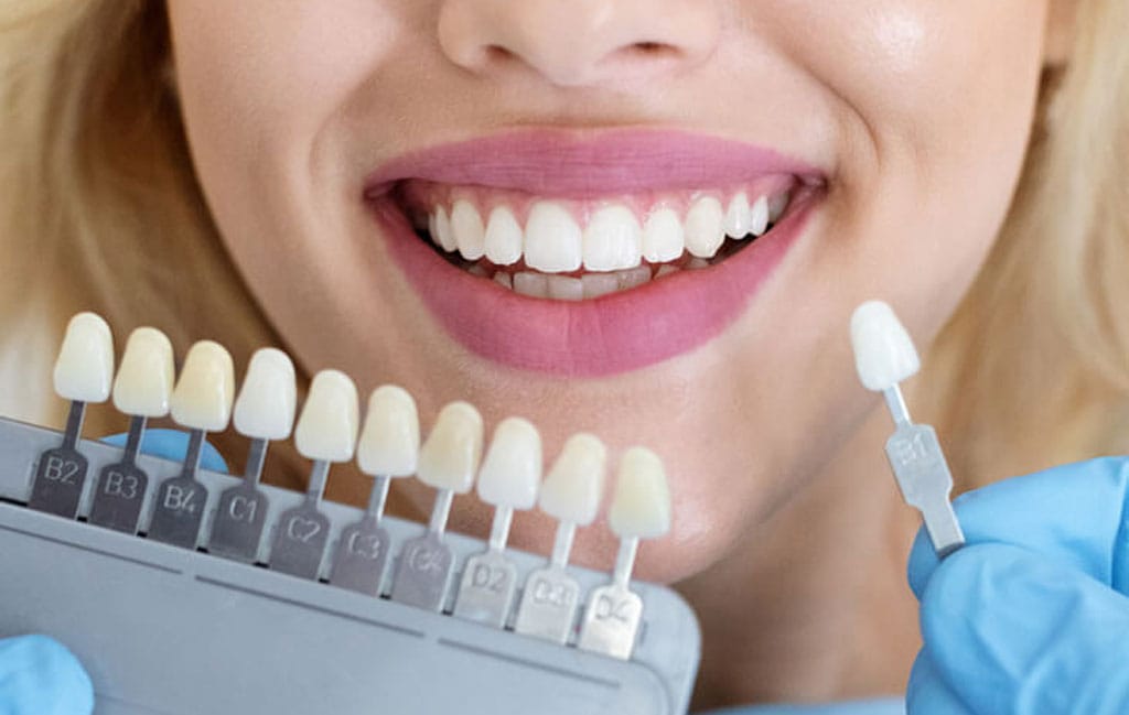 کدام کامپوزیت دندان بهتر است؟