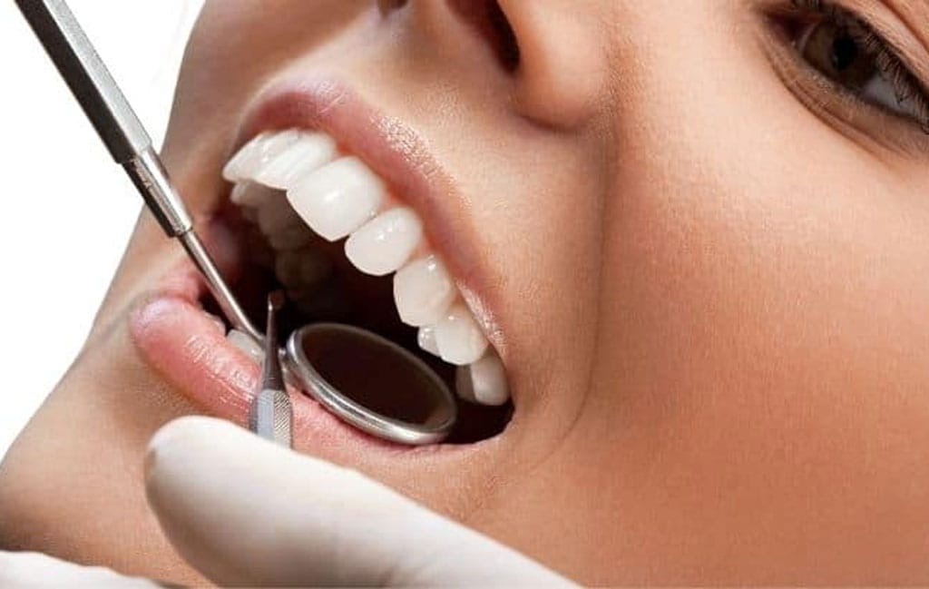 علت زرد شدن کامپوزیت دندان چیست؟