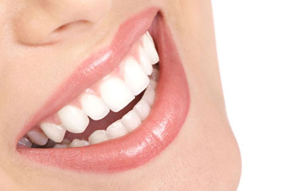 عادت هایی که باید بعد از کامپوزیت دندان ترک کرد!!