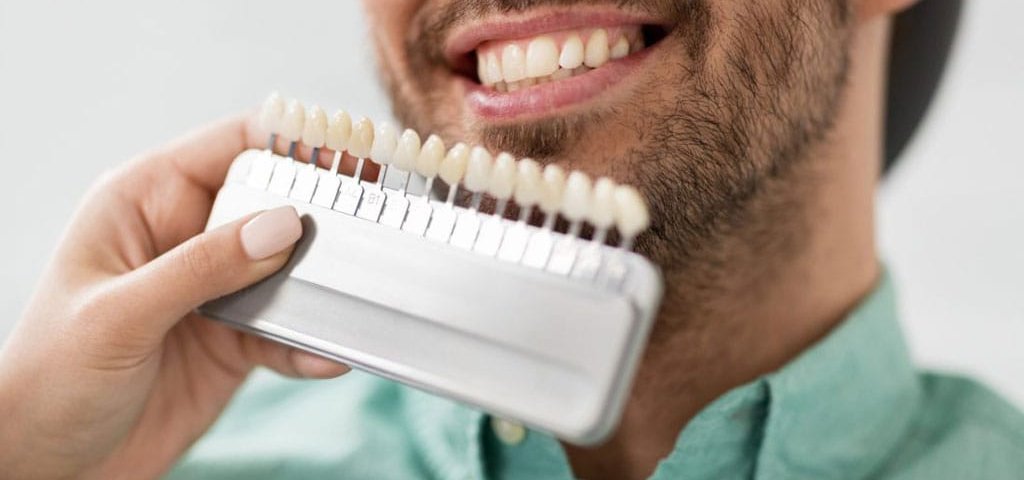 چه کسانی کاندید مناسب برای کامپوزیت دندان هستند؟