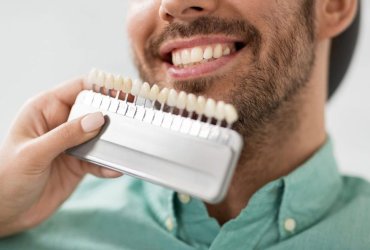 چه کسانی کاندید مناسب برای کامپوزیت دندان هستند؟