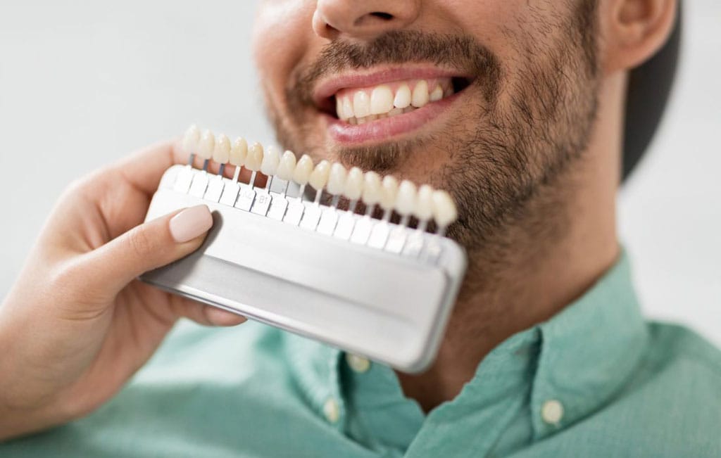 چه کسانی کاندید مناسب برای کامپوزیت دندان هستند؟