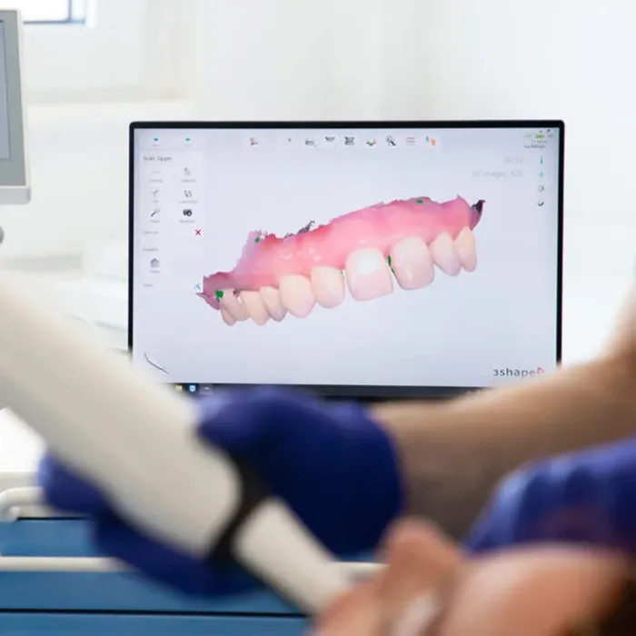 ایمپلنت دیجیتال