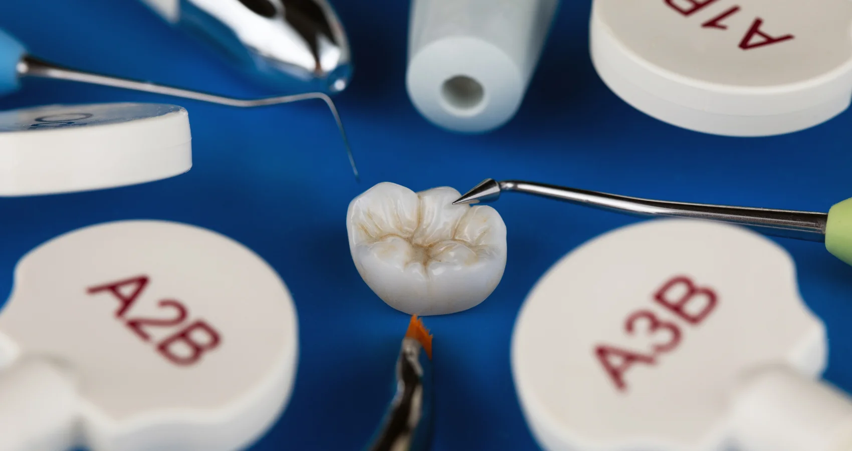 نمونه آنله دندان