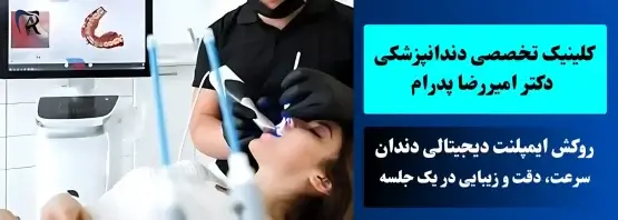 اسکن دیجیتالی برای ایمپلنت دیجیتال دندان | سرعت دقت و زیبایی در یک جلسه