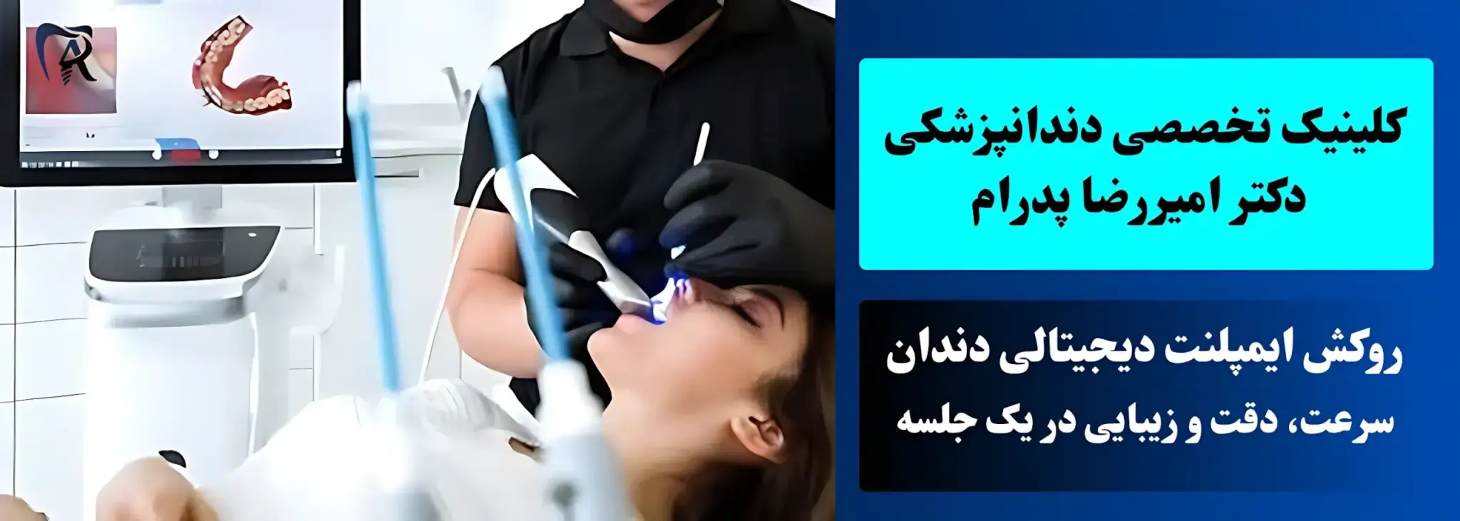 اسکن دیجیتالی برای ایمپلنت دندان | سرعت دقت و زیبایی در یک جلسه