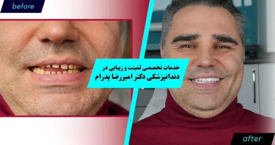 خدمات زیبایی و لمینت دندان در کلینیک دکتر پدرام