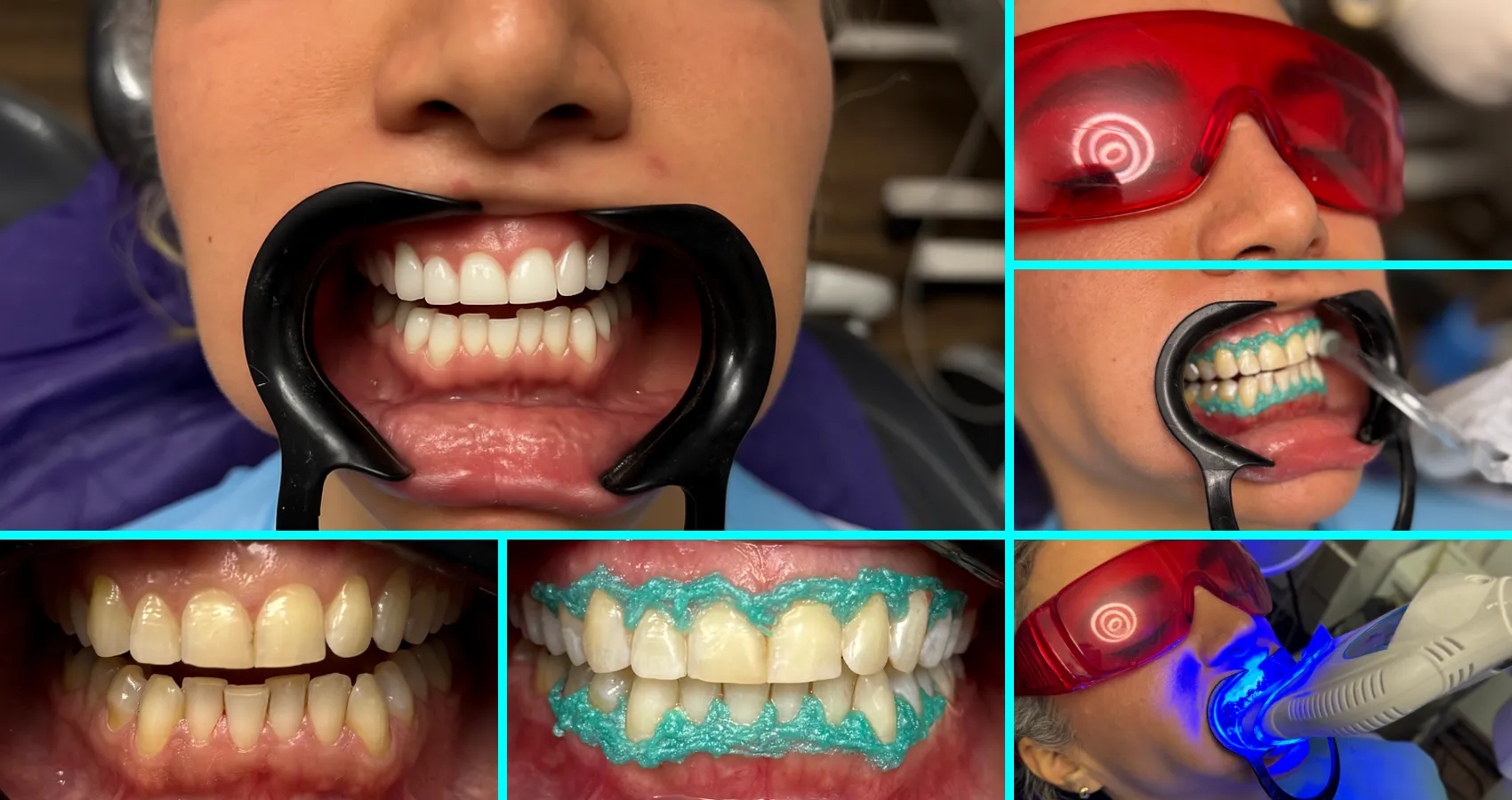 نمونه کار شطرنجی خدمات زیبایی دکتر امیررضا پدرام