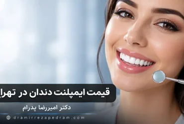 قیمت ایمپلنت دندان در تهران