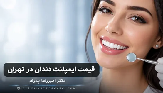 قیمت ایمپلنت دندان در تهران