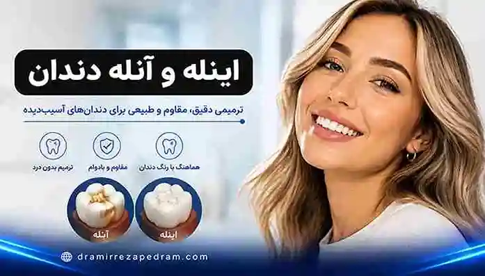 اینله و آنله دندان
