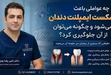 شکست ایمپلنت دندان