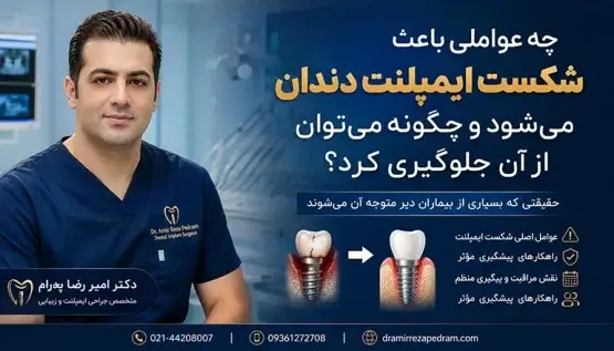 شکست ایمپلنت دندان