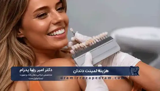 قیمت لمینت دندان در تهران