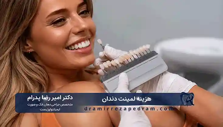قیمت لمینت دندان در تهران
